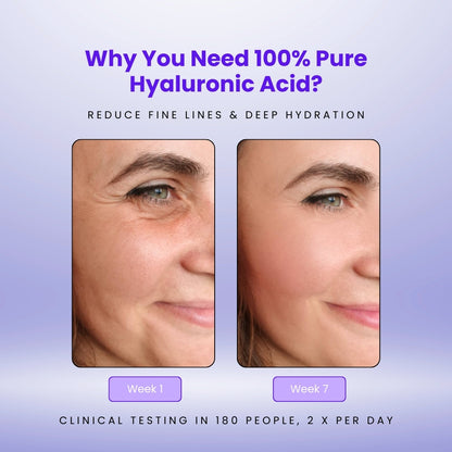 FURORA™ Hyaluronic Acid Powder