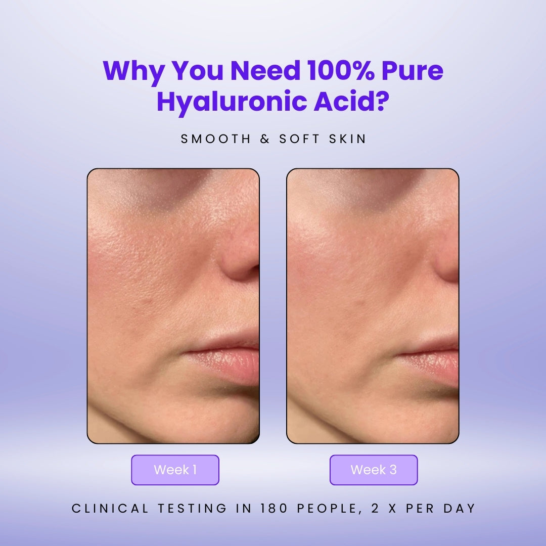 FURORA™ Hyaluronic Acid Powder